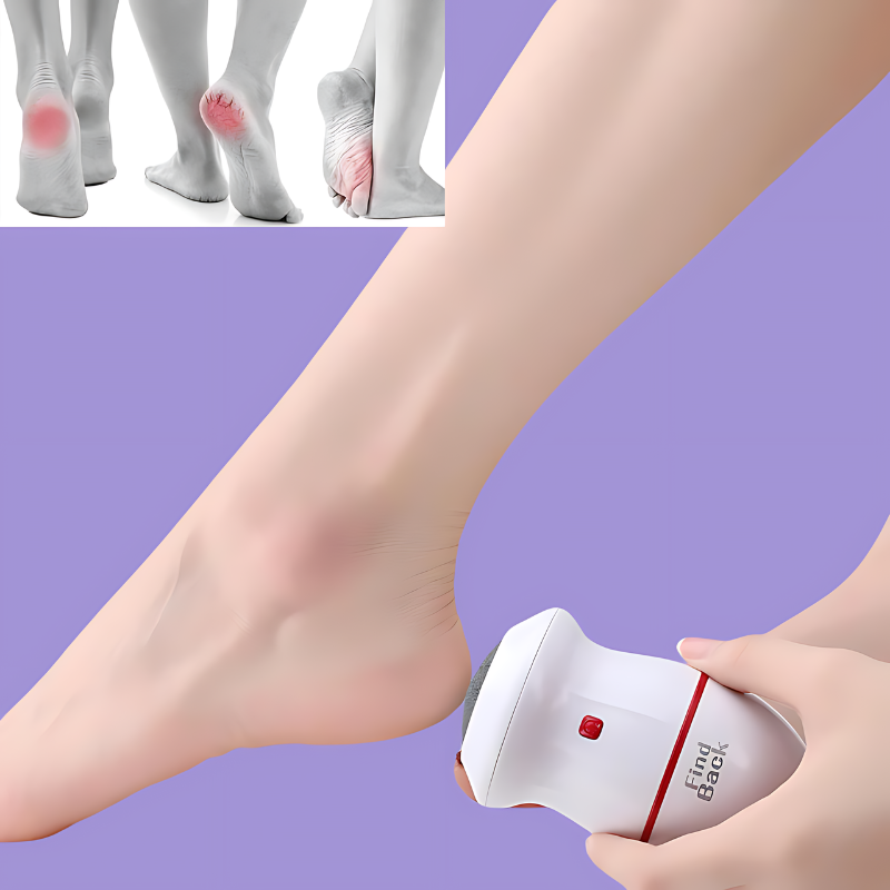 2 in 1 Electric Callus Remover for Feet, With Free Foot Polish 🎉