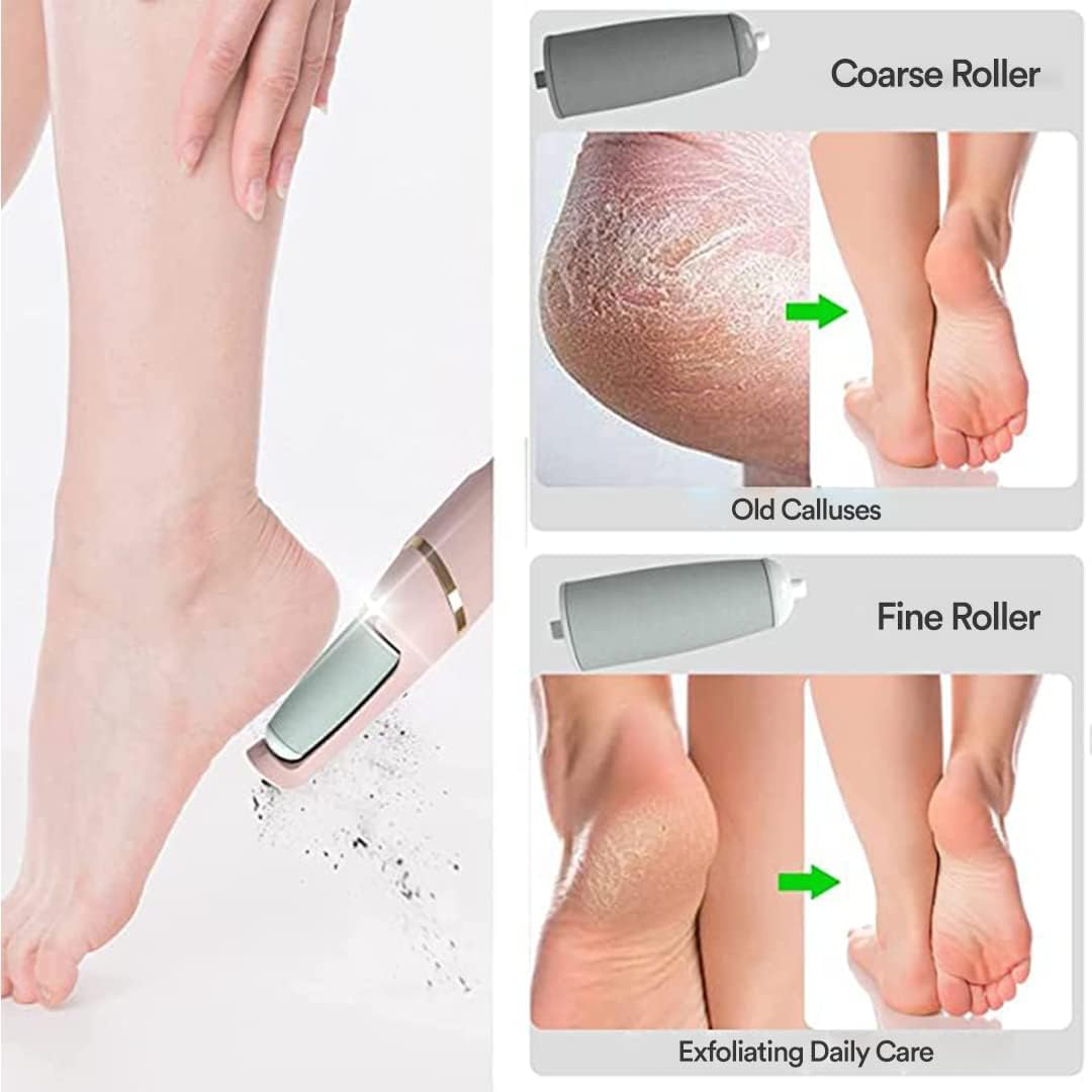 Foot Callus Remover - Smart, Rechargeable ✨